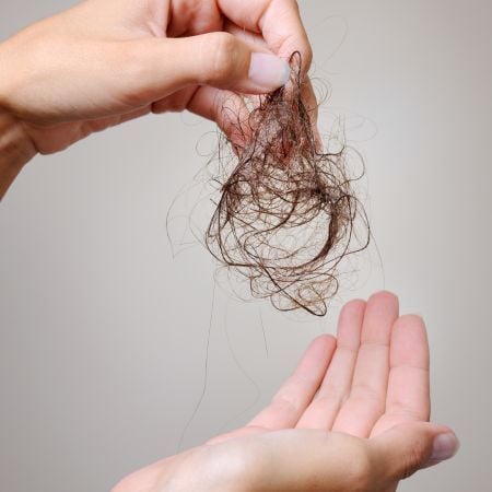 Rụng tóc - nỗi lo của các chị em